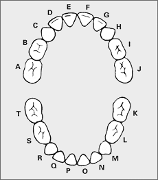 wisdom teeth extraction San Francisco